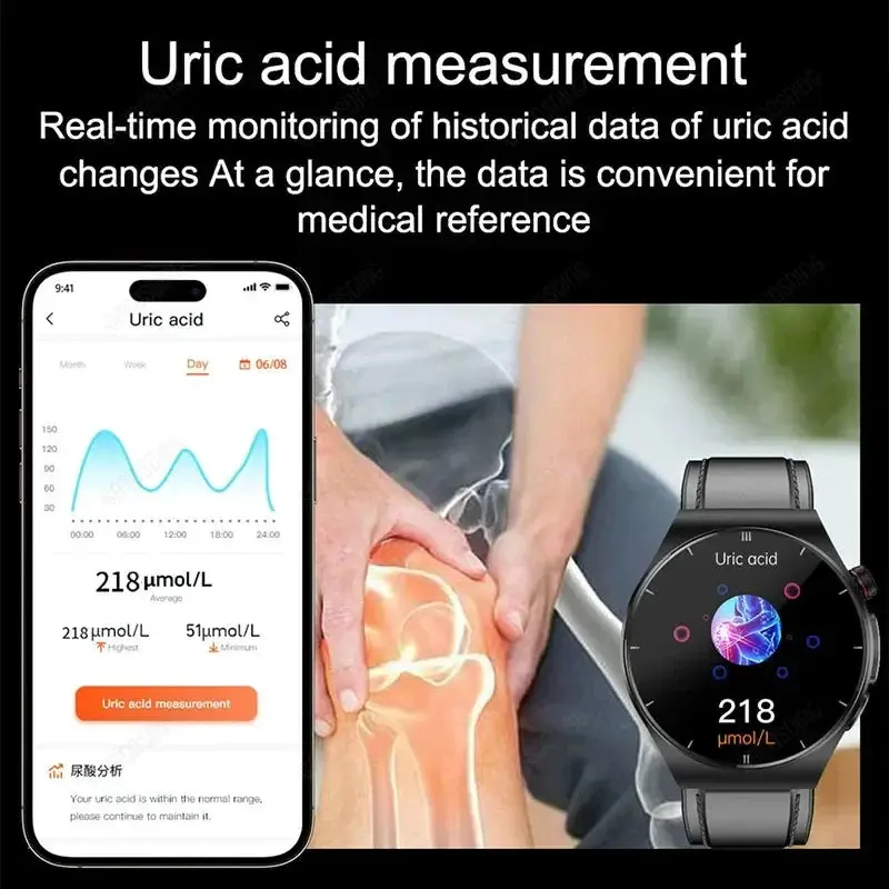 Elegance® Laser Treatment Smartwatch Blood Glucose Blood Oxygen Uric Acid Lipid Health Monitoring
